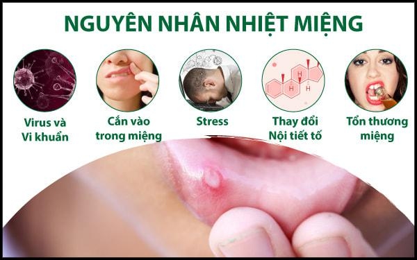 Thuốc chữa nhiệt miệng