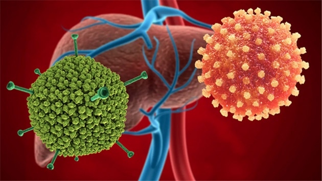 Viêm gan A à một bệnh nhiễm trùng cấp tính ở gan do virus viêm gan A (HAV) gây ra