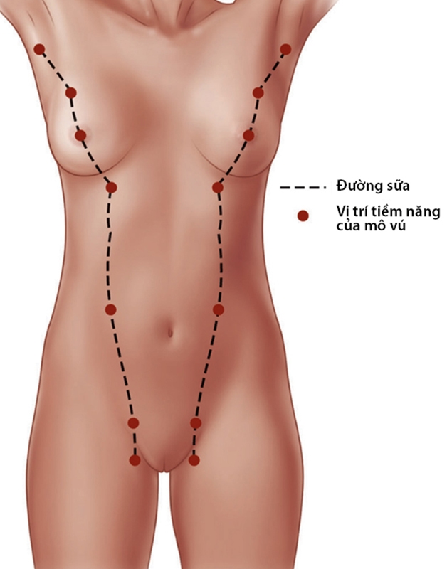 Đường sữa và vị trí tiềm năng xuất hiện các mô vú, bao gồm tuyến vú phụ ở nách.