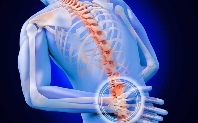 Viêm cột sống dính khớp là gì và thông tin tổng quan