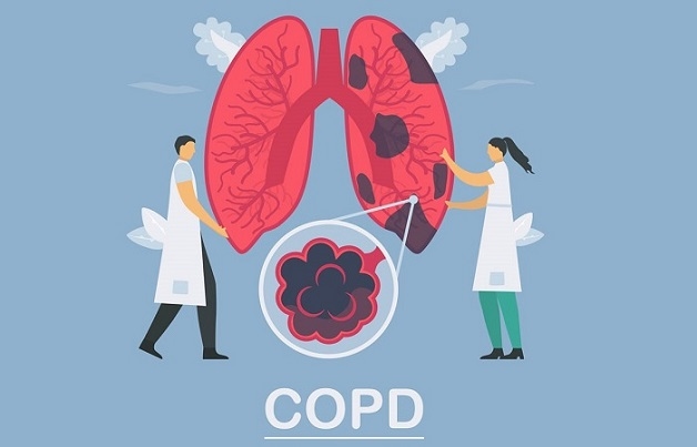 Bệnh COPD có điều trị khỏi được không?