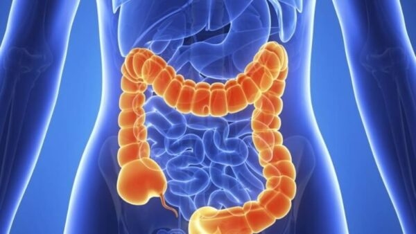 Bệnh Crohn là gì? Nguyên nhân và cách điều trị