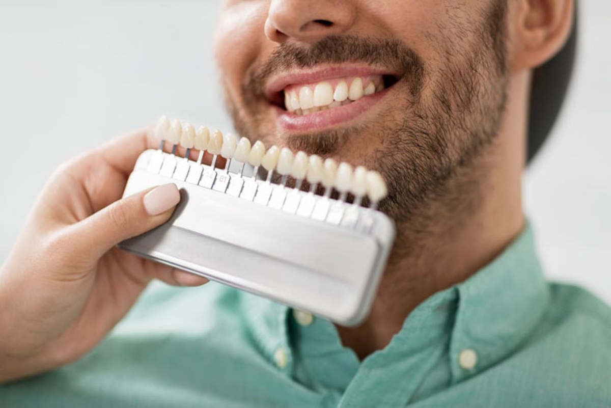 Cách chọn bọc răng sứ màu nào đẹp và phù hợp nhất
