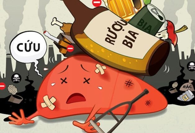 Thoái hóa mỡ ở gan do rượu là nhóm nguyên nhân phổ biến và cũng nguy hiểm nhất