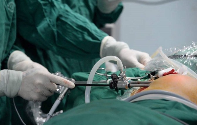 Phẫu thuật nhân giảm âm tuyến vú có thể thực hiện bằng phương pháp mổ mở hoặc mổ nội soi.