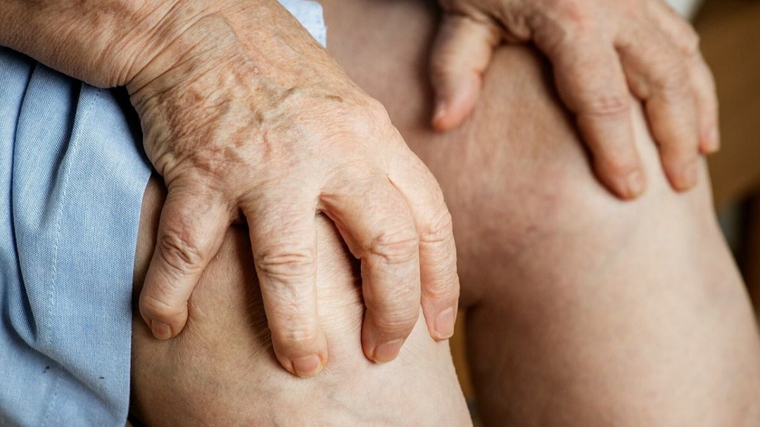 Viêm khớp dạng thấp điều trị an toàn, hiệu quả