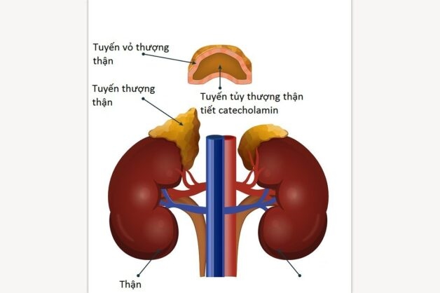 Teo tuyến thượng thận là tình trạng gây khó chịu với người bệnh