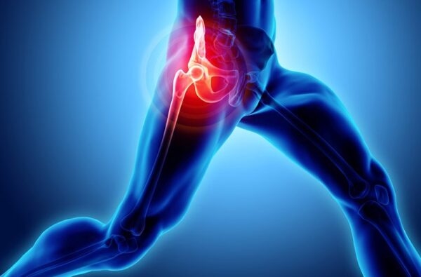 Một số bệnh lý thường gặp ở khớp háng