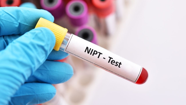 Ý nghĩa của phương pháp xét nghiệm sàng lọc trước sinh NIPT