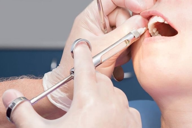 Thực hiện trồng răng có đau không