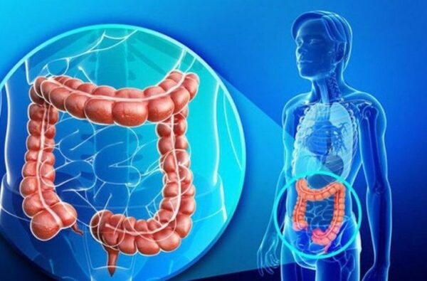 Viêm ruột kích thích là gì? Dấu hiệu nhận biết