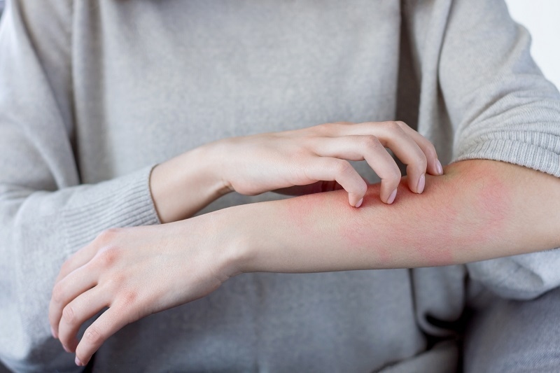 Medrol 16mg có công dụng gì?