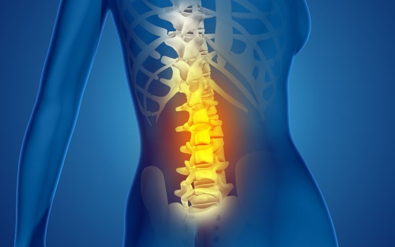 Thoái hoá đốt sống lưng là tình trạng thoái hoá của các đĩa đệm đốt sống.