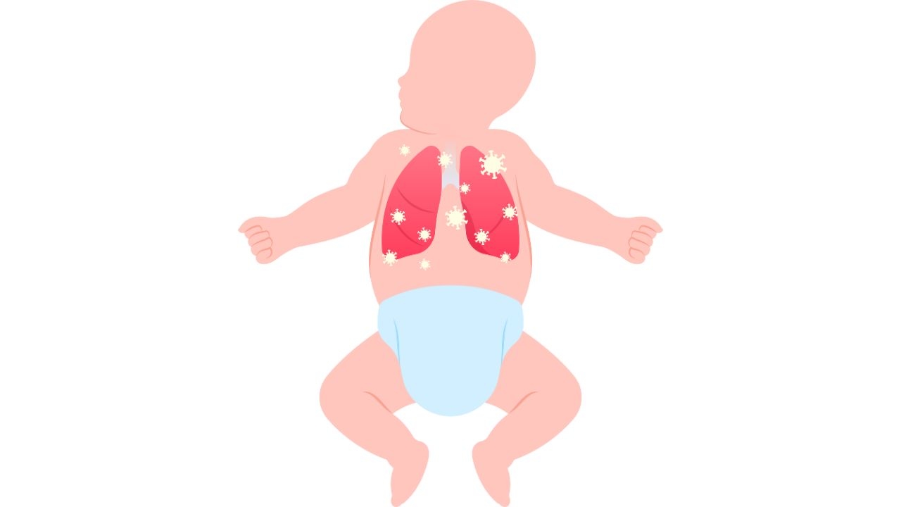 Trẻ sơ sinh viêm phổi: Nhận biết sớm để điều trị kịp thời