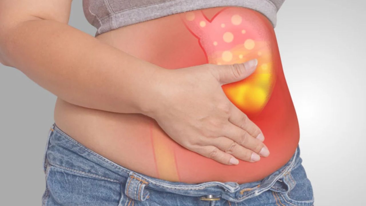 Simethicone &#8211; Dược chất dùng cải thiện triệu chứng đầy hơi