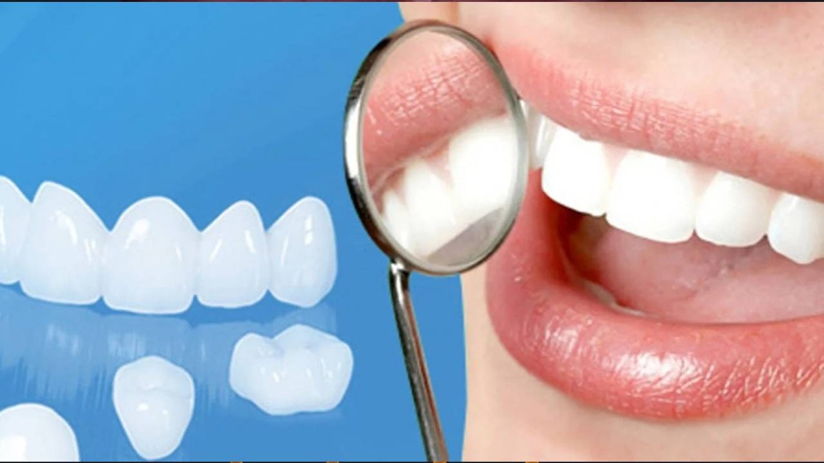 Bọc răng sứ có đau không &#8211; Review đánh giá chi tiết