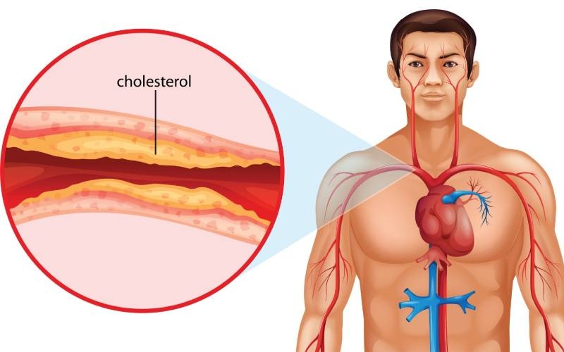 Atorvastatin 10mg và bệnh tim mạch