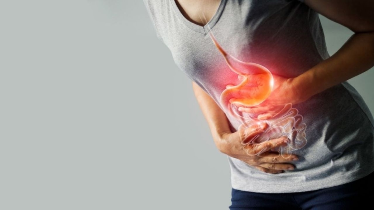Nóng bụng ợ chua: Dấu hiệu bệnh gì và cách điều trị