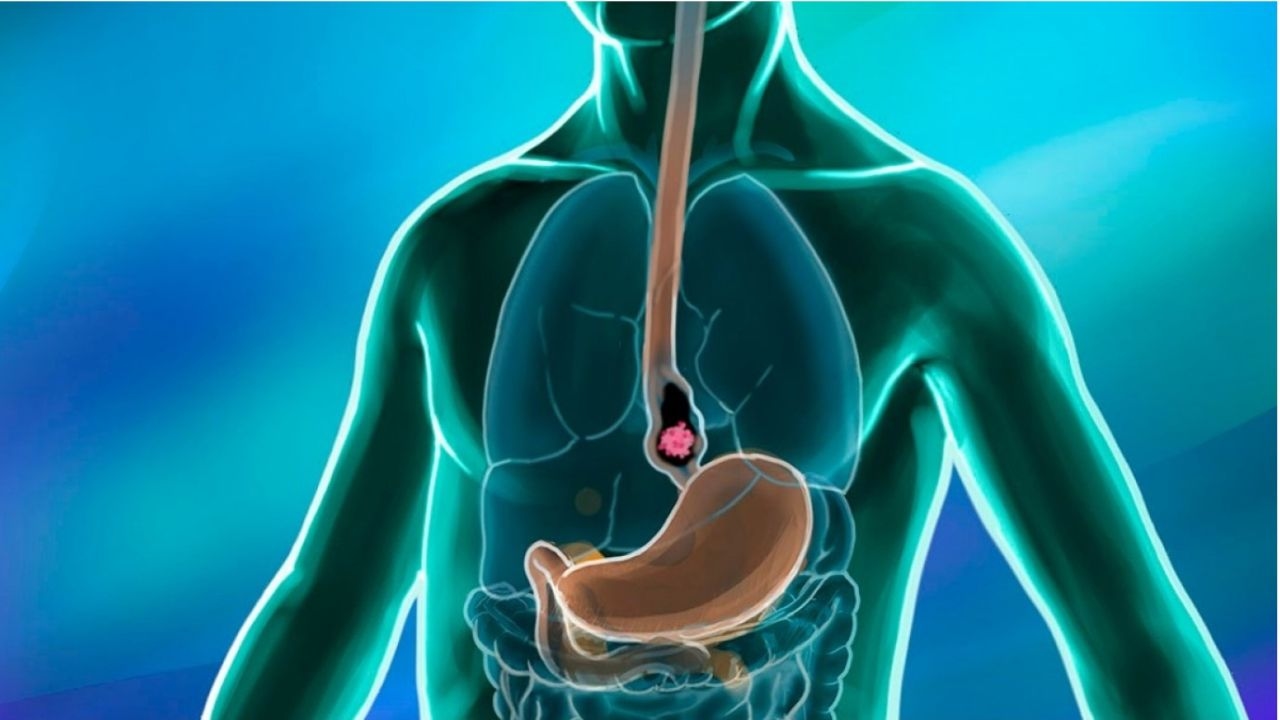 Tìm hiểu ợ nóng có hại không, nguyên nhân và cách điều trị