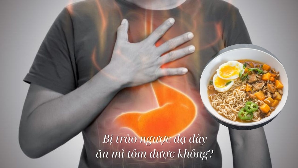 Tìm hiểu trào ngược dạ dày ăn mì tôm được không