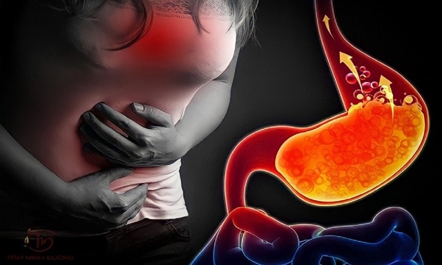 Trị trào ngược cần chú ý những gì?