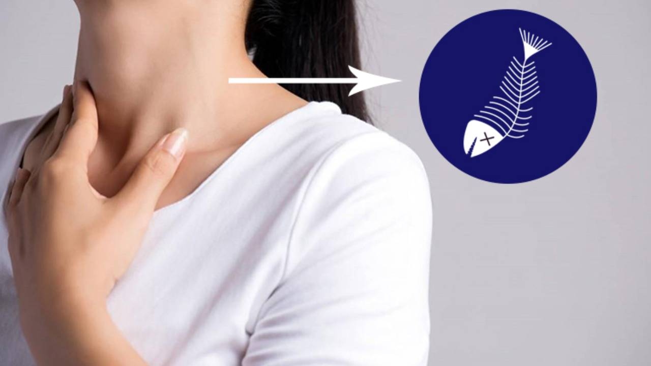 Cách trị khi bị hóc xương cá – Những điều bạn cần biết