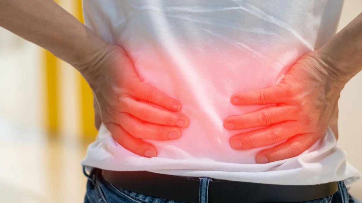 Dấu hiệu bị thận ứ nước do sỏi thận: Cách nhận biết và điều trị