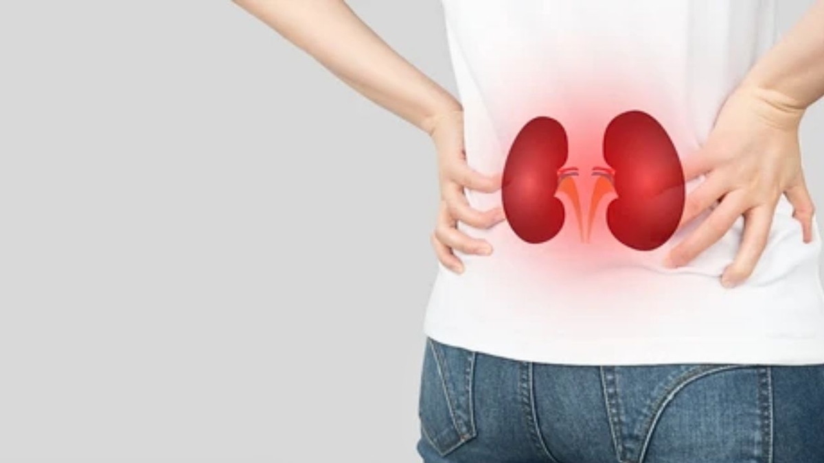 Giãn đài bể thận độ 2: Những điều cần biết để bảo vệ thận