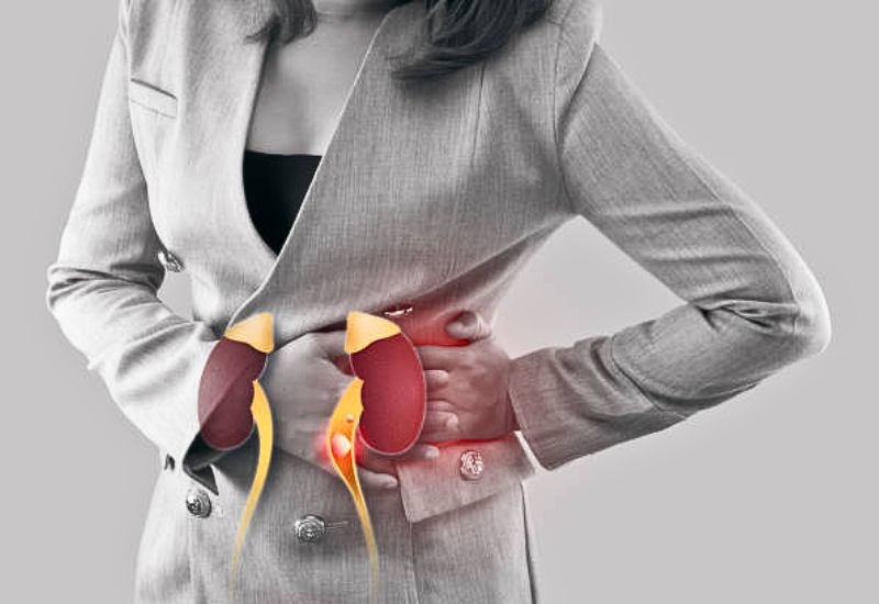 Nguyên nhân gây thận ứ nước cấp độ 4