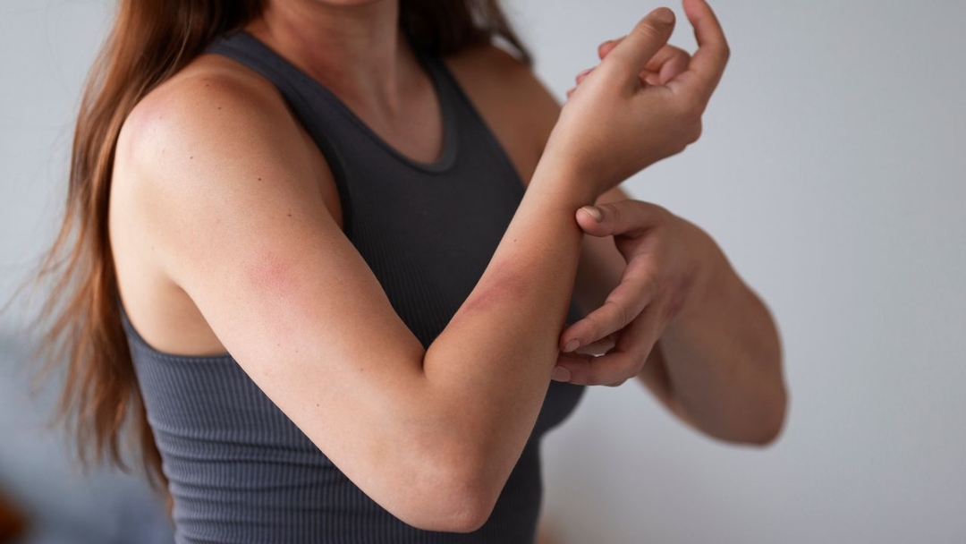 Tiêm vắc-xin bị ngứa: Nguyên nhân và cách khắc phục hiệu quả