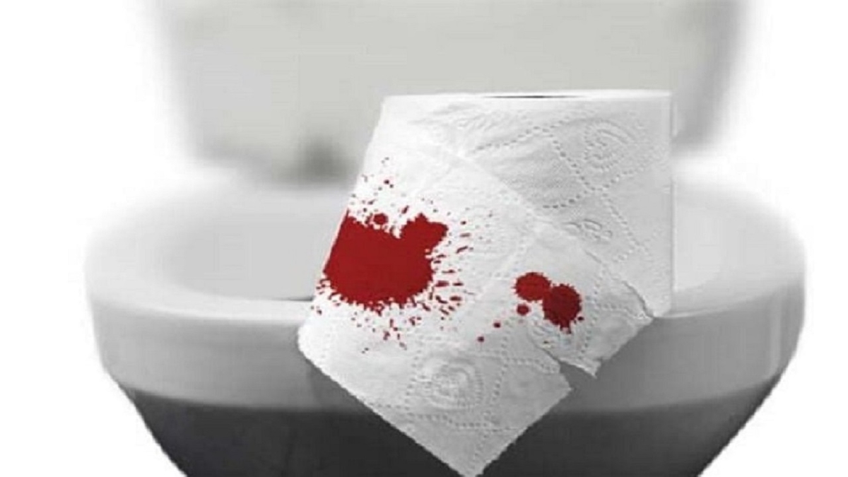 Cảnh báo tình trạng trĩ nội đi ngoài ra máu