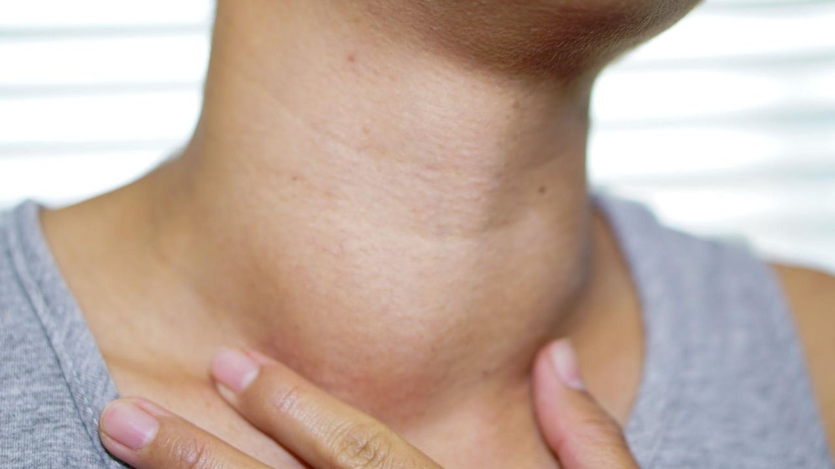 Vì sao cường giáp gây hạ kali máu và cách kiểm soát?
