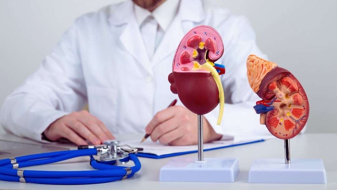 Đài bể thận giãn do sỏi tắc nghẽn: Cách xử lý để tránh biến chứng