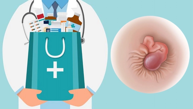 Chữa bệnh trĩ ở đâu: Tiêu chí giúp bạn tìm địa chỉ phù hợp nhất