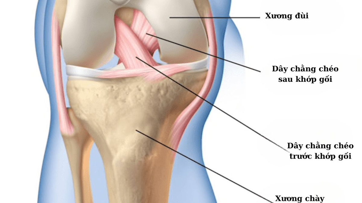 Phân biệt dây chằng chéo trước và dây chằng chéo sau khớp gối