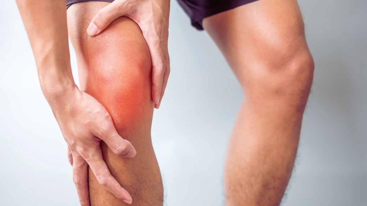 Nguy cơ thoái hóa khớp sau chấn thương dây chằng chéo khớp gối