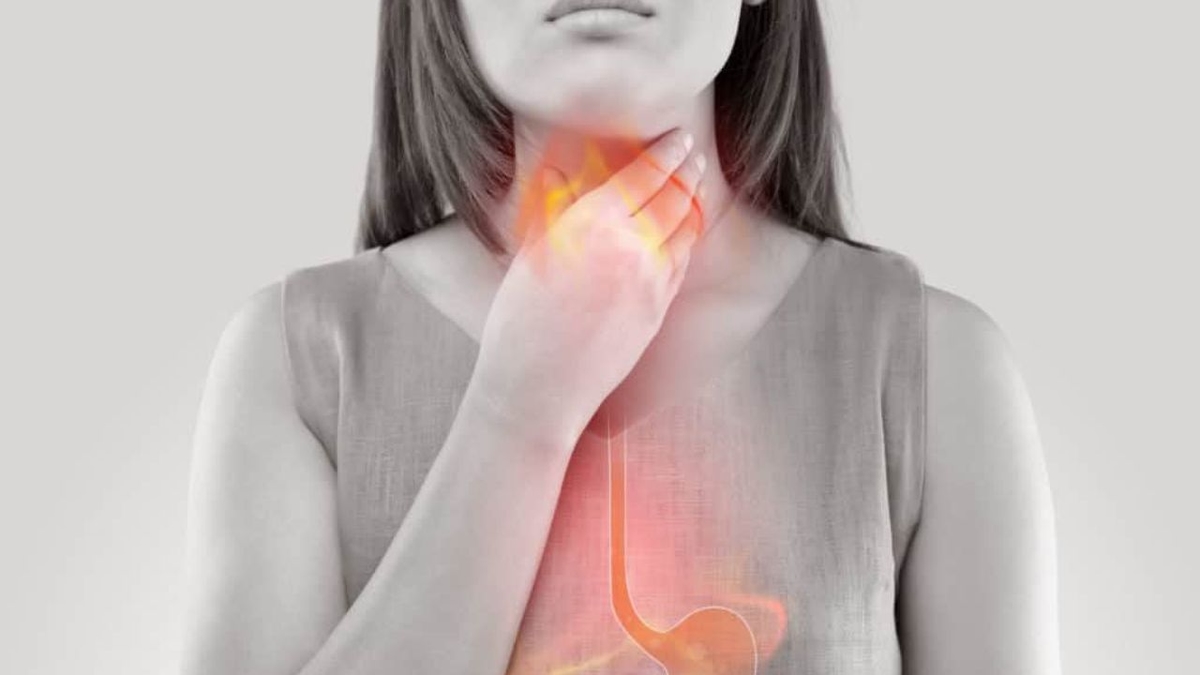 Trào ngược dạ dày gây ho kéo dài: chớ coi thường