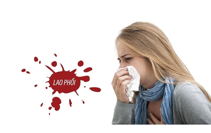Đường lây nhiễm của lao 