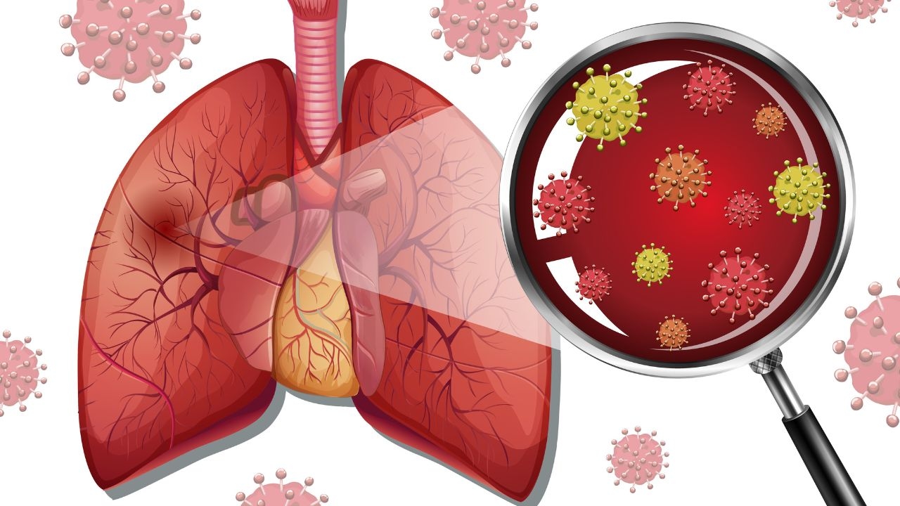 5 Điều bạn cần biết về viêm phổi kẽ