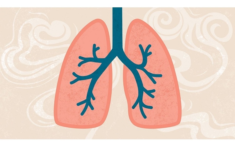 bệnh copd 