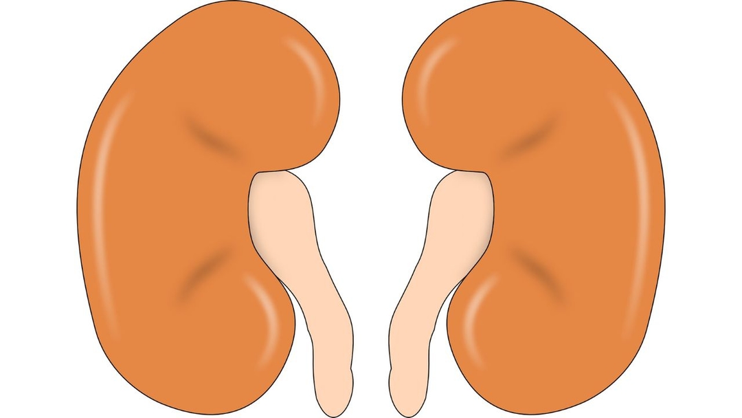 Vì sao bị đài bể thận giãn độ 3: Cơ chế và các yếu tố nguy cơ