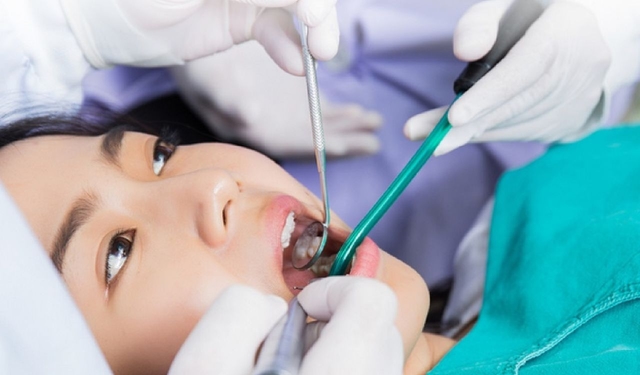 Có nên nhổ răng mọc lệch không? Và những điều bạn cần lưu ý
