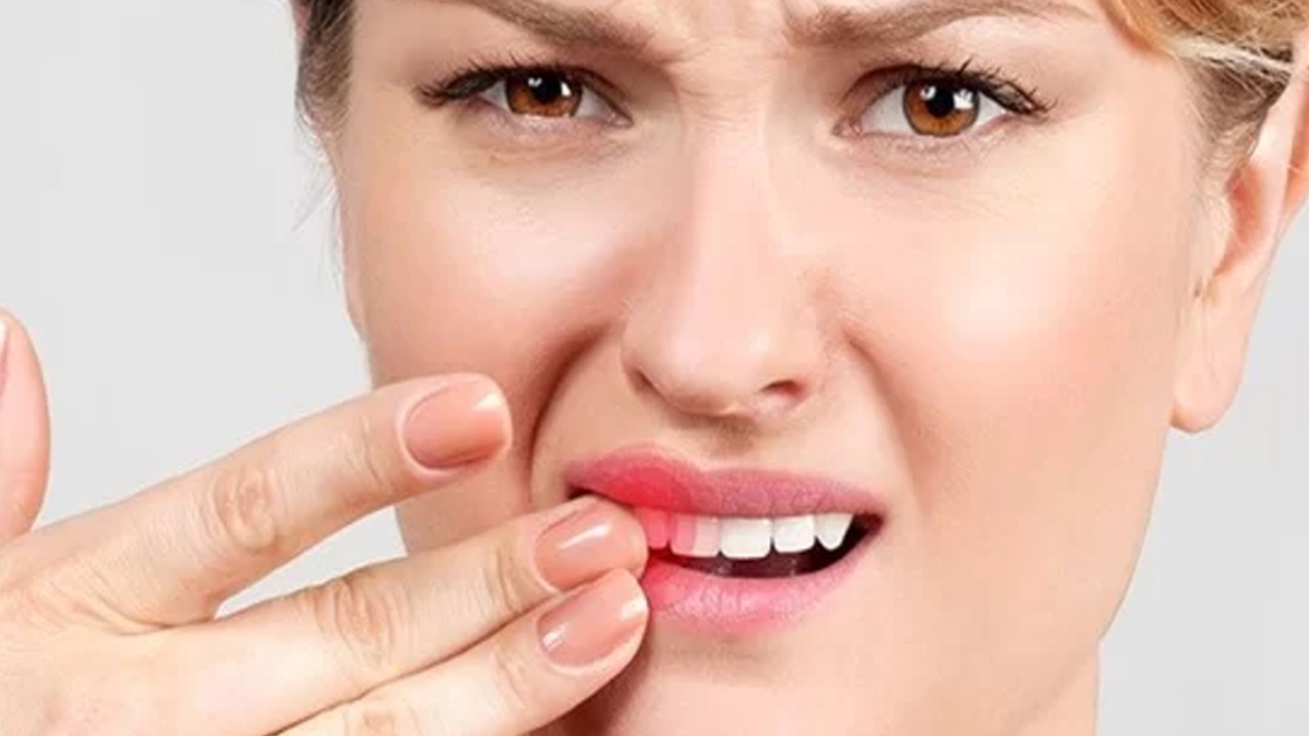 Răng lung lay có giữ được không &#8211; giải đáp cụ thể