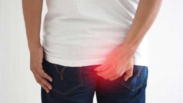 Trĩ ngoại triệu chứng thế nào: Top 6 biểu hiện bạn cần chú ý