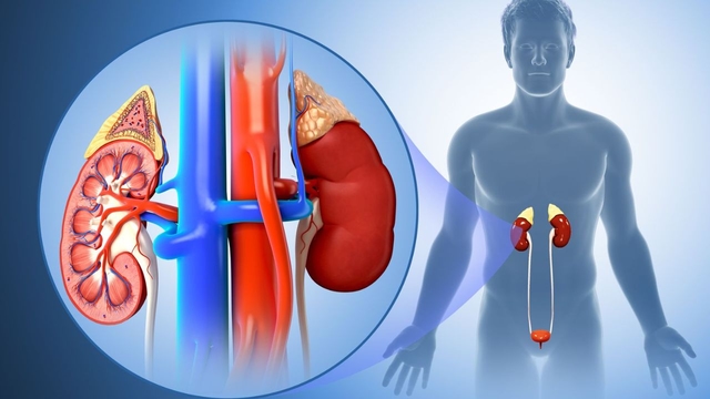 Bệnh thận ứ nước có nguy hiểm không nếu chỉ bị 1 bên