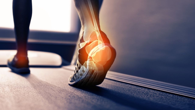 Những cảnh báo sức khỏe từ tình trạng đau khớp gót chân