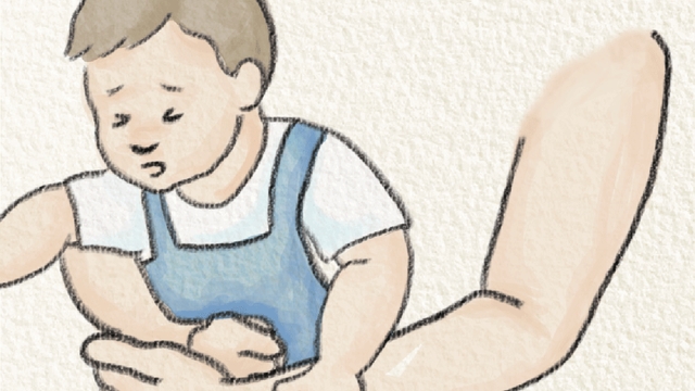 Hóc dị vật ở đường thở &#8211; Tai nạn cần cảnh giác