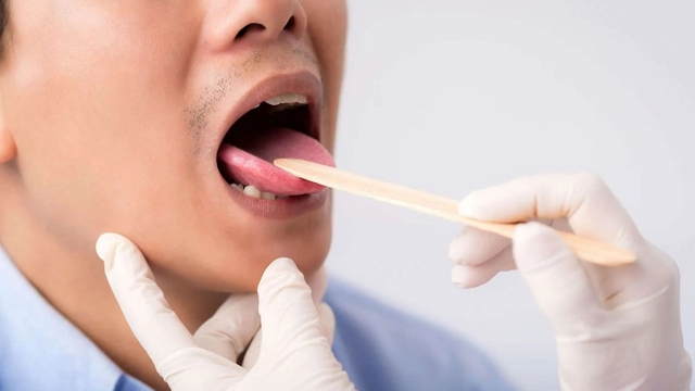Nhận biết biểu hiện ung thư miệng lưỡi