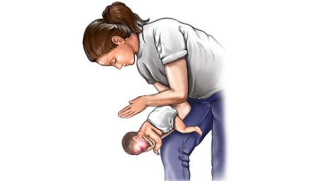 Trẻ bị hóc dị vật đường thở: Nguy hiểm không thể xem nhẹ