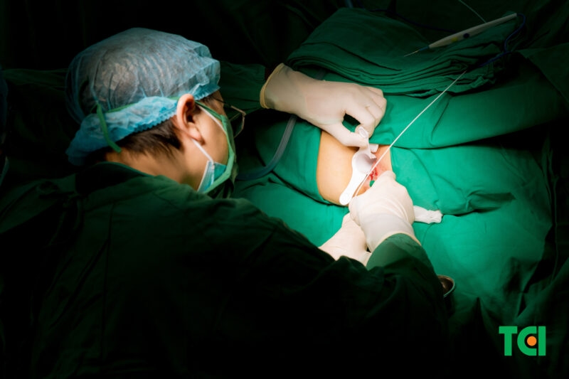 Một ca đốt trĩ bằng Laser Diode chỉ kéo dài khoảng 30 phút